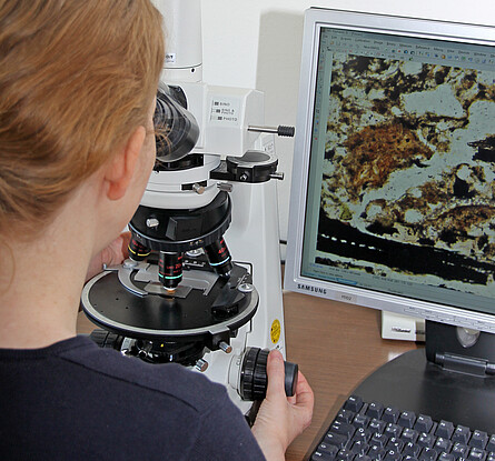 Mikroskopanalyse Eine Wissenschaftlerin schaut durchs Mikroskop und kann das Bild auch auf einem Monitor sehen.